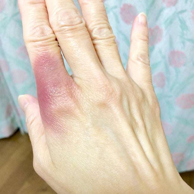 アッヘンバッハ症候群のお客様【京都市中京区四条河原町漢方錦】